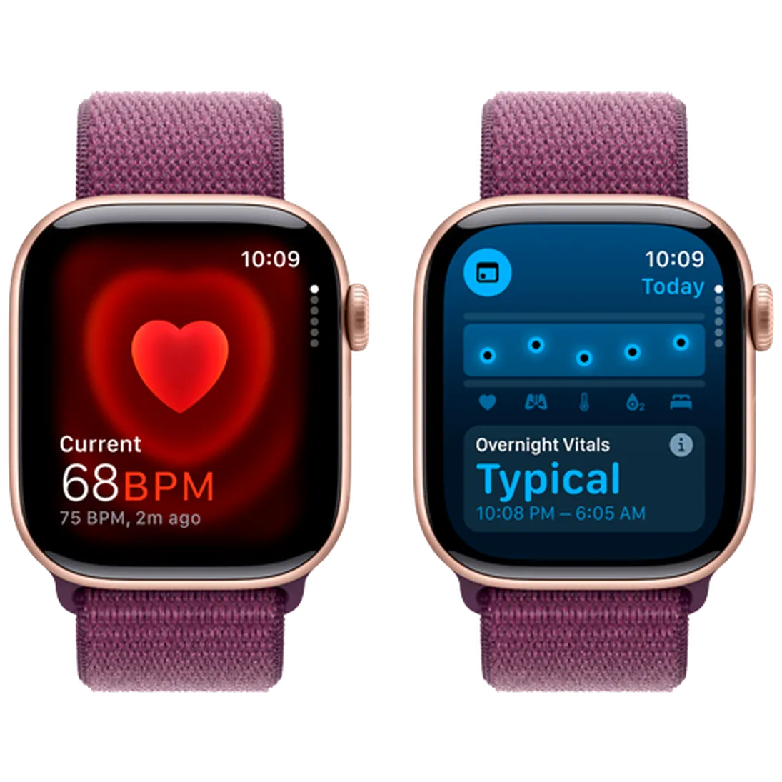 Pametni sat APPLE Watch S10 4G 42mm Gold, Purple Nylon Strap (MWXC3QF/A)