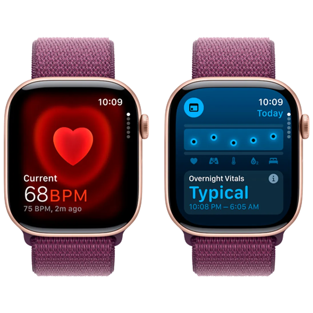 Pametni sat APPLE Watch S10 4G 46mm Gold, Purple Nylon Strap (MWY83QF/A)