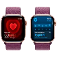 Pametni sat APPLE Watch S10 4G 42mm Gold, Purple Nylon Strap (MWXC3QF/A)